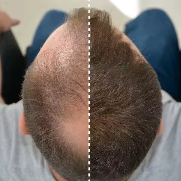 Fibra de pelo Rubio medio 25 g